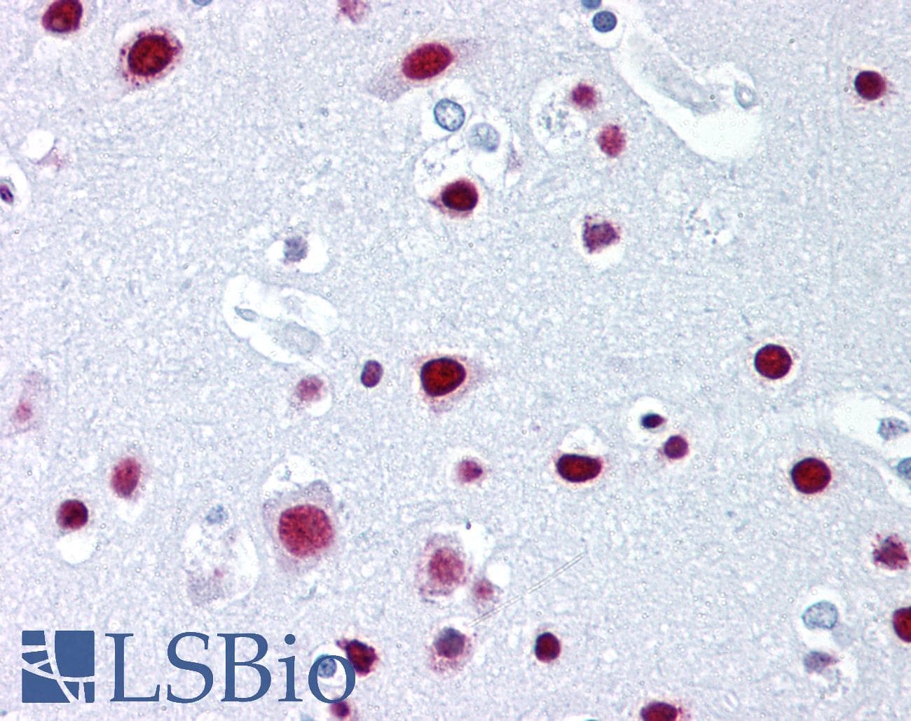 IHC-plus™ Monoclonal Mouse anti-Human SAFB1 / SAFB Antibody (clone 6F7, aa345-357, IHC, IF, WB)