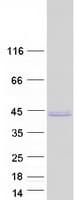 Human HNRNPA1L2 Protein (Recombinant Myc-DDK (Flag))