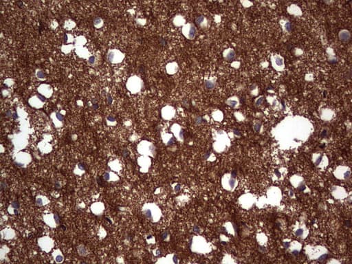 NCAM / CD56 Antibody (aa20-718, clone OTI1C7, Carrier-free)