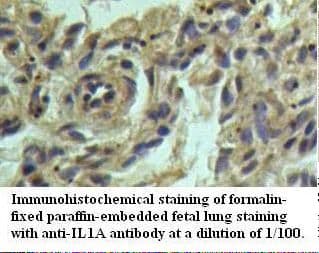 Polyclonal Rabbit anti-Human IL1A / IL-1 Alpha Antibody (IHC, WB)