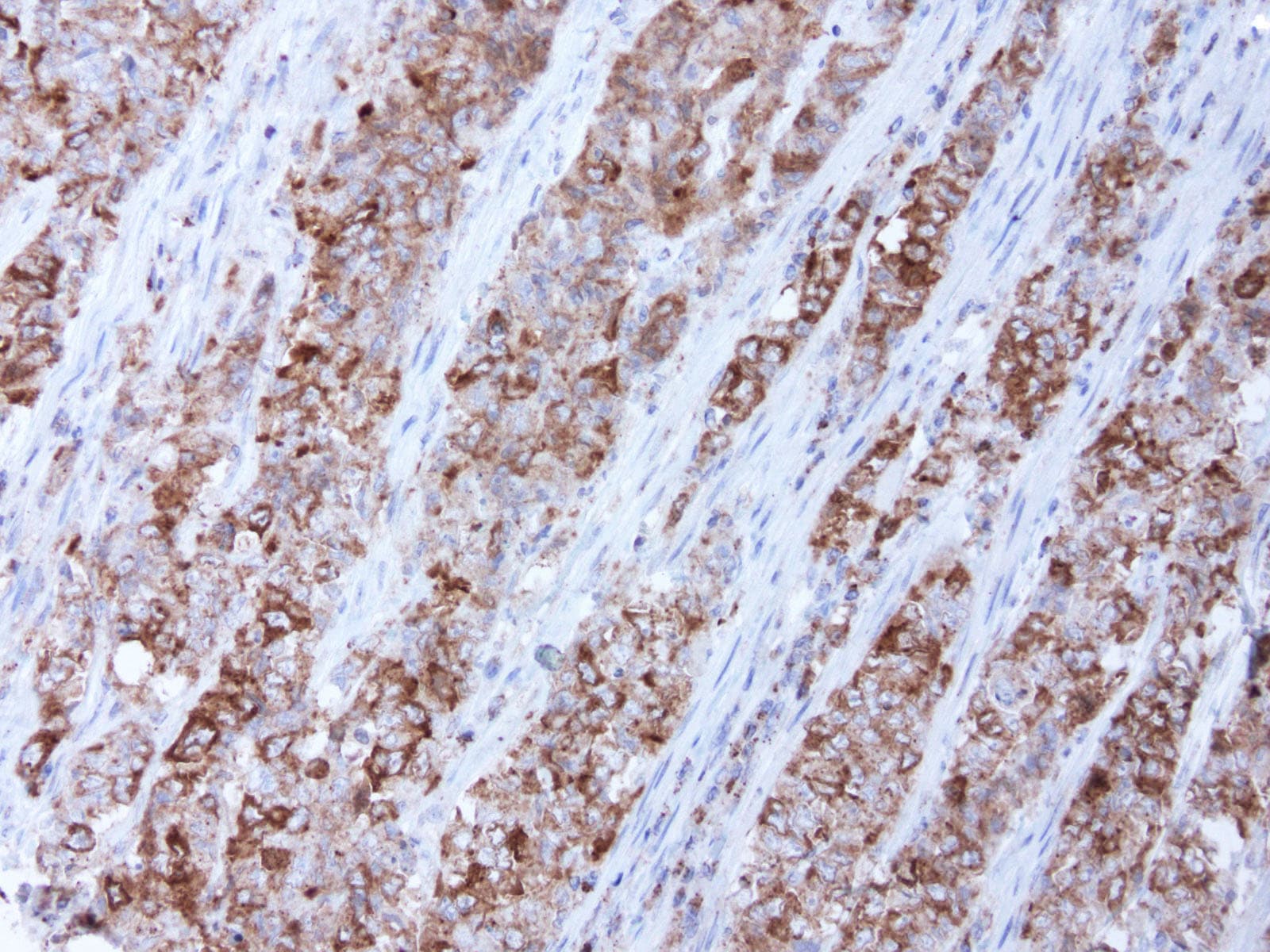 BUB1B / BubR1 Antibody (clone UMAB7, Carrier-free)