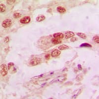 IHC-plus™ Polyclonal Rabbit anti-Human ANXA1 / Annexin A1 Antibody (Internal, IHC, IF, WB)