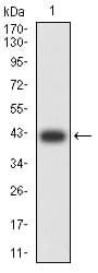 Monoclonal Mouse anti-Human BCAT2 Antibody (clone 7G3A11, WB)