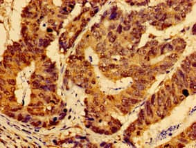 Polyclonal Rabbit anti-Human AHSA2 Antibody