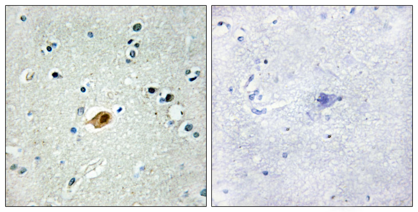 Polyclonal Rabbit anti-Human Sox8+9+17+18 Antibody (Internal, IHC, WB)