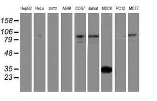 ATRIP Antibody (aa42-309, clone OTI9A4)