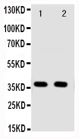 Polyclonal Rabbit anti-Human ANXA10 / Annexin A10 Antibody (aa308-324, IHC, WB)
