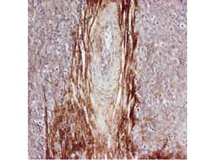 PathPlus™ SPP1 / Osteopontin Antibody