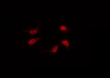 Vitamin D Receptor / VDR Antibody (phospho-Ser208)