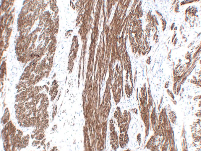 CNN1 / Calponin Antibody (clone ABT-CALP)