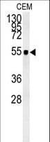 ZIC3 Antibody (aa239-267)