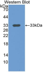 LRG1 / LRG Antibody (aa39-308)