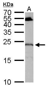 RGS4 Antibody (aa1-205)