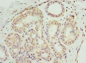 Polyclonal Rabbit anti-Human SOST / Sclerostin Antibody (aa24-213, IHC)