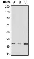 MED22 Antibody (N-Terminus)