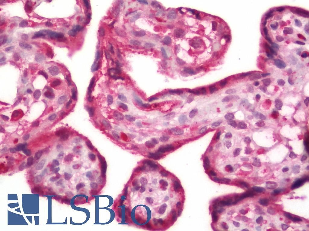 IHC-plus™ Polyclonal Guinea pig anti-Rabbit MMP1 Antibody (IHC, WB)
