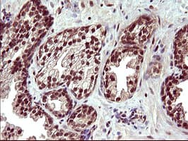 UPRT Antibody (clone OTI3A3, Carrier-free)