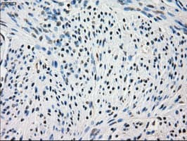 FRK Antibody (clone OTI5G4)