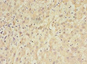 TET3 Antibody