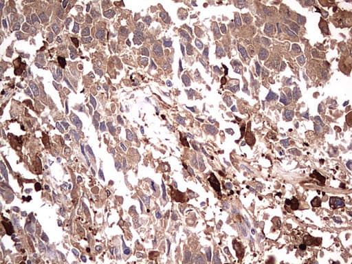 TRIM27 Antibody (clone OTI4D4)