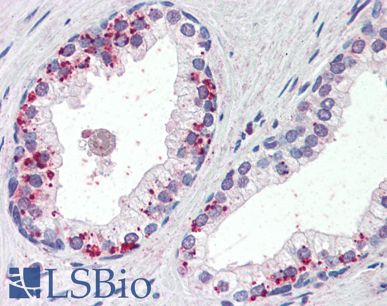 IHC-plus™ ANXA1 / Annexin A1 Antibody (aa324-337)