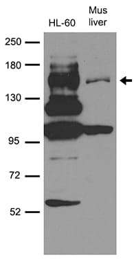 MAP3K5 / ASK1 Antibody