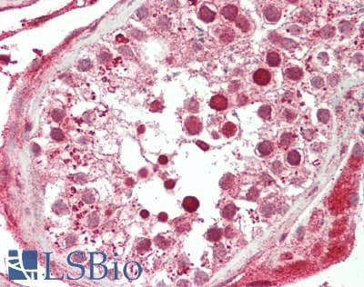 PathPlus™ CX3CL1 / Fractalkine Antibody (aa25-332)