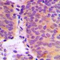 CHPF / CHSY2 Antibody (C-Terminus)