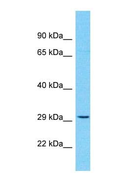 OR10H5 Antibody (aa236-285)