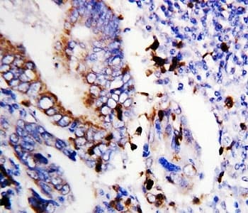 BCL2L1 / BCL-XL Antibody (aa120-130)