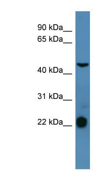 Polyclonal Rabbit anti-Human SSTR1 Antibody (aa251-300, IHC, WB)