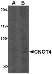 IHC-plus™ CNOT4 / CLONE243 Antibody