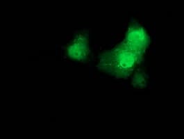 CTNNB1 / Beta Catenin Antibody (clone OTI2F6)