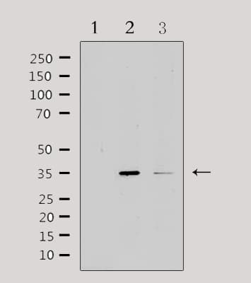 IL20RB Antibody