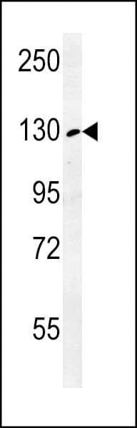 RTL1 Antibody (aa1330-1358)