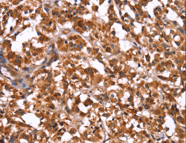 GUK1 / Guanylate Kinase 1 Antibody