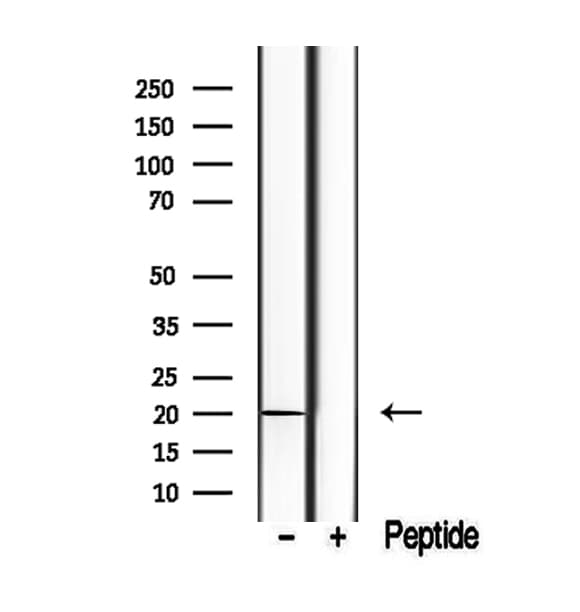 Polyclonal Rabbit anti-Human TIMM17B Antibody (IHC, WB)