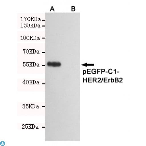 ERBB2 / HER2 Antibody