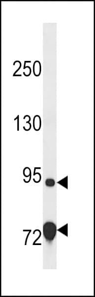 Polyclonal Rabbit anti-Human EXD3 Antibody (aa340-367, WB)