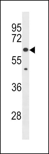 Polyclonal Rabbit anti-Human KLHL30 Antibody (aa514-542, WB)
