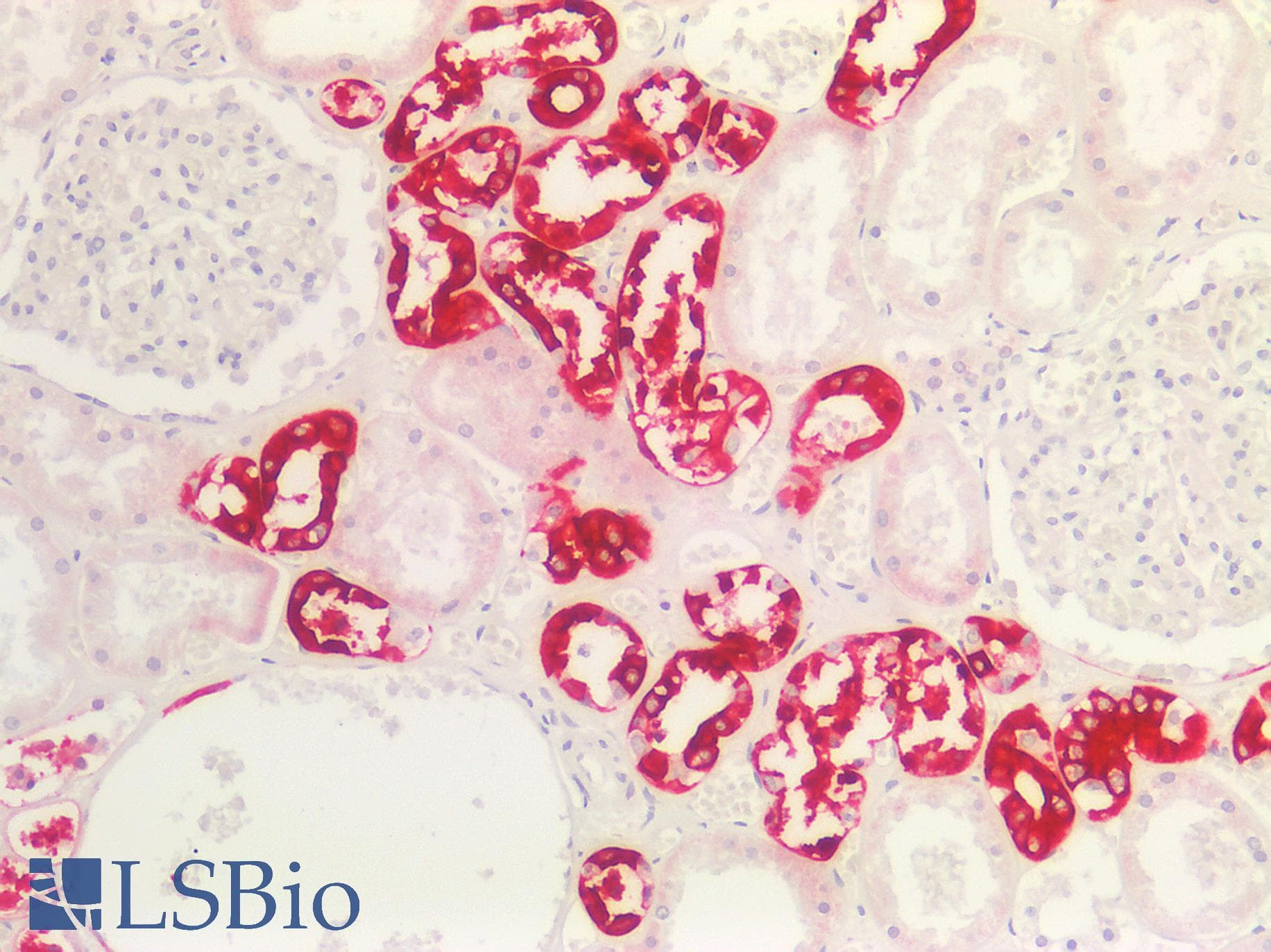 PathPlus™ Acidic Cytokeratin AE1 Antibody (clone AE-1, Concentrated)