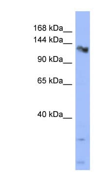CHERP Antibody (aa683-732)