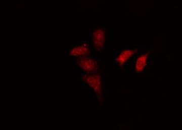 EAR2 / NR2F6 Antibody