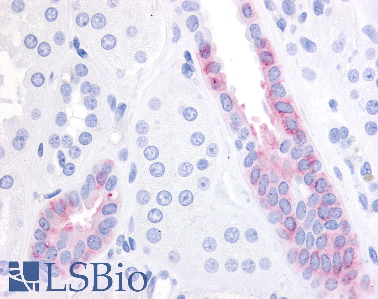 IHC-plus™ GPR1 Antibody (C-Terminus)