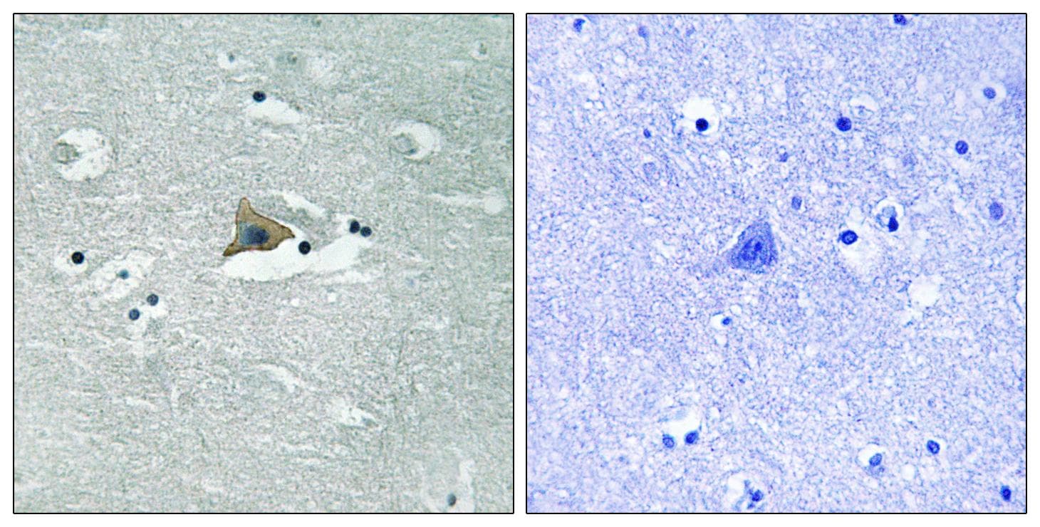 CLDN5 / Claudin 5 Antibody (phospho-Tyr217)