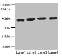 MTERF3 / MTERFD1 Antibody