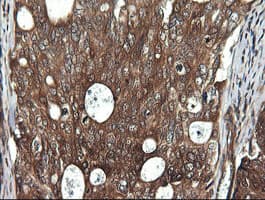 DDX58 / RIG-1 / RIG-I Antibody (clone OTI6C1, Carrier-free)