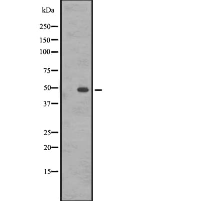 Polyclonal Rabbit anti-Human CCKBR / Cckb Antibody (IHC, IF, WB)
