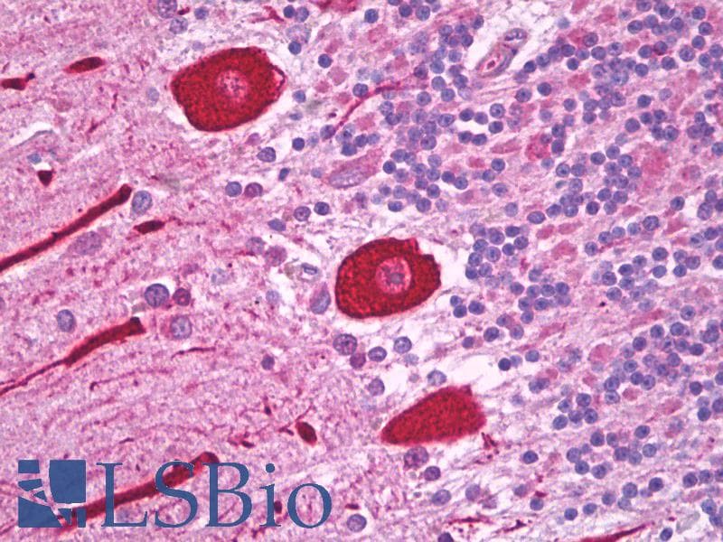 IHC-plus™ Alpha Tubulin Antibody (C-Terminus, clone YL1/2)