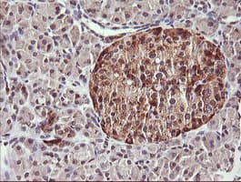 CHGA / Chromogranin A Antibody (clone OTI2D7)